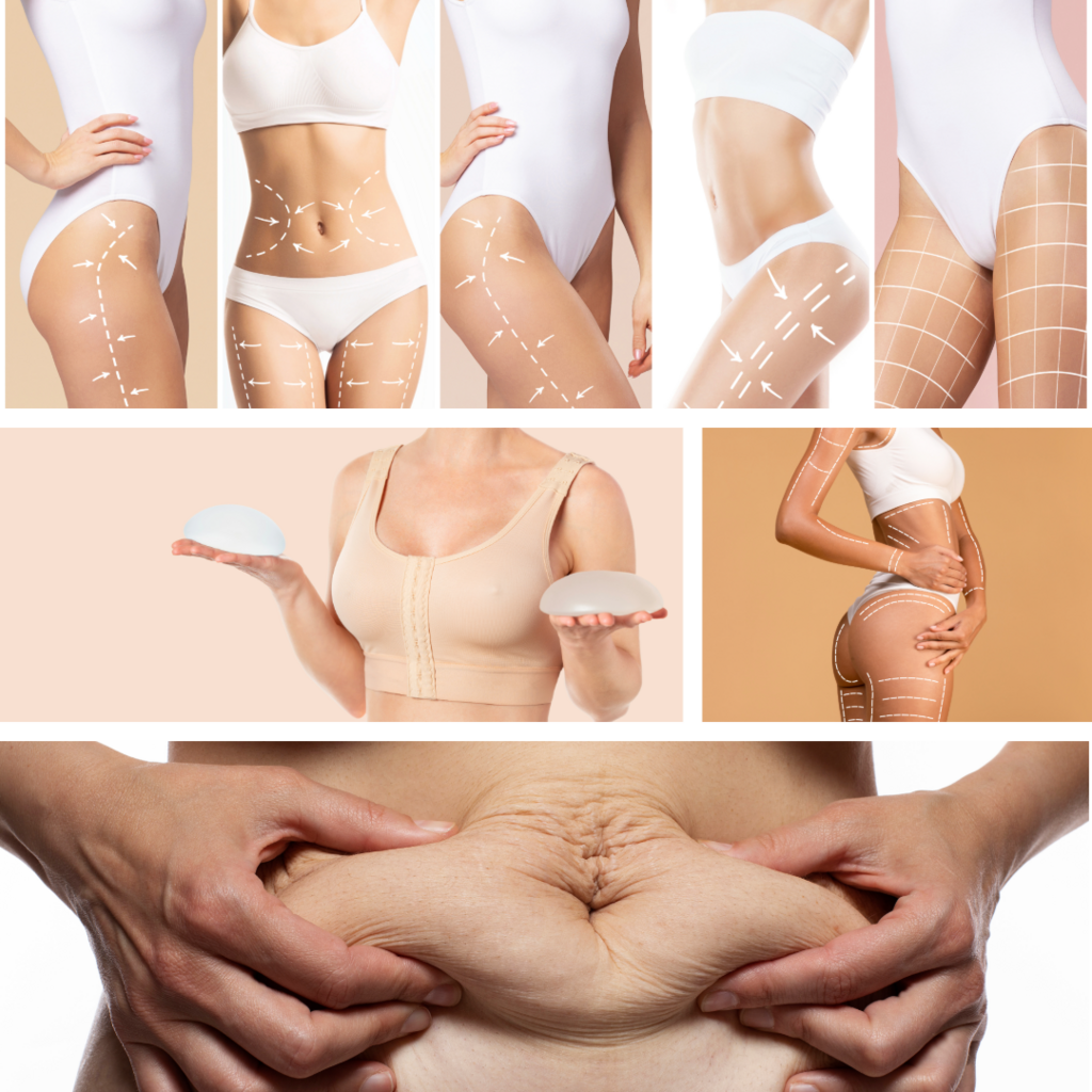 Most popular recovery procedures